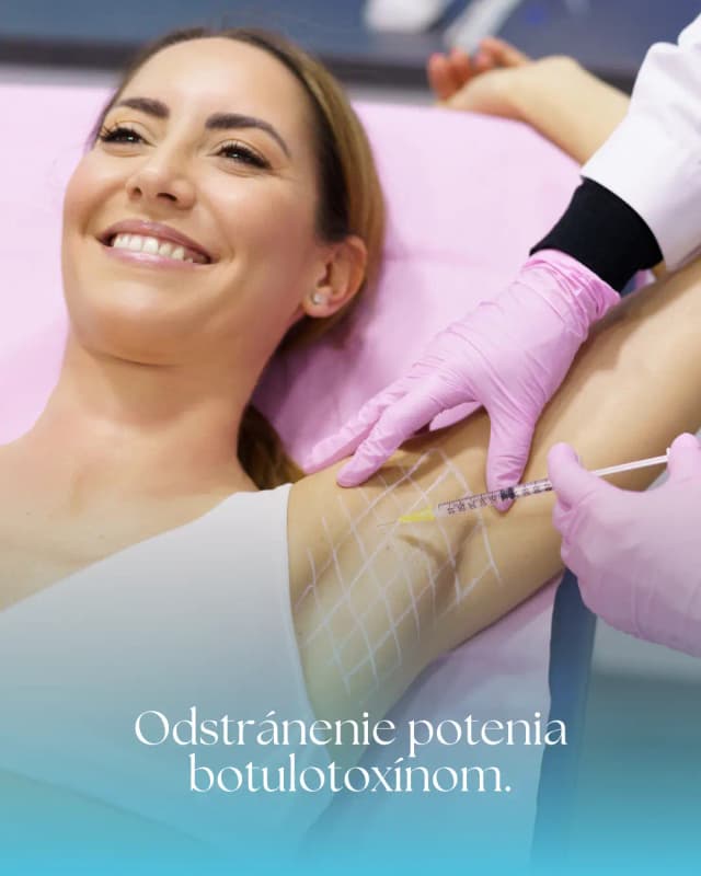 Odstránenie potenia